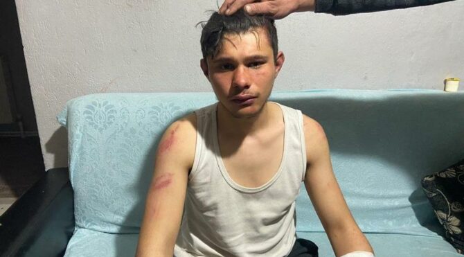 16 yaşındaki gence işkence etmişlerdi! Şüpheliler yakalandı