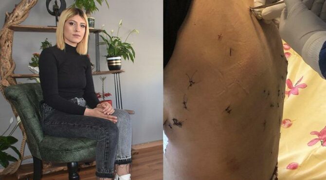 Boşanmak istediği eşi tarafından 38 yerinden bıçaklanan 2 çocuk annesi: ‘Bu son yemeğin’ diyerek bıçakladı