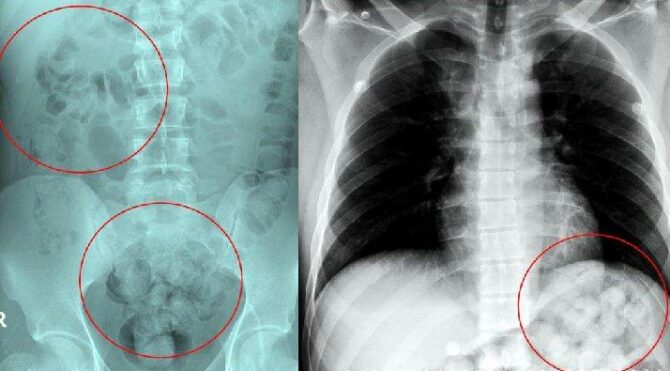 Doktorlar şaşkına döndü… Zehirlenince yakayı ele verdi