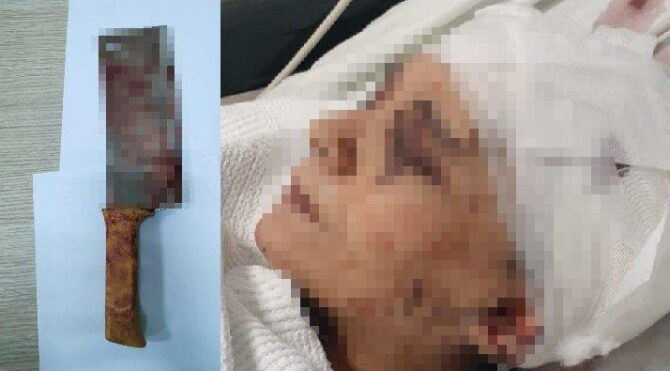 ‘Kadın kısmı çalışmaz’ dedi… Eşine satırla saldırdı ‘Kadın kısmı çalışmaz’ dedi… Eşine satırla saldırdı