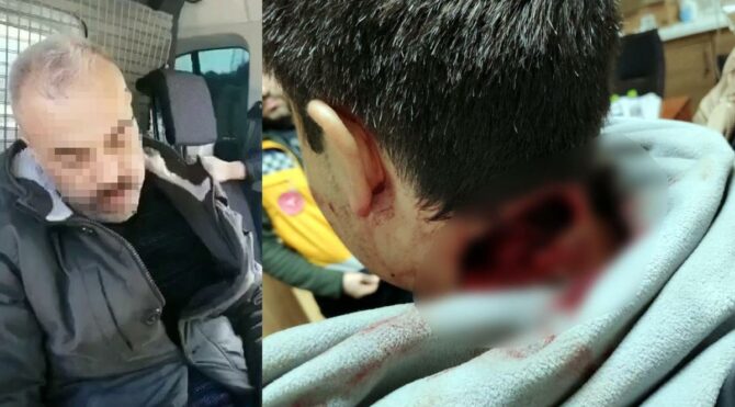 Oğlunu keserek ağır yaralayan babanın kan donduran ifadeleri ortaya çıktı