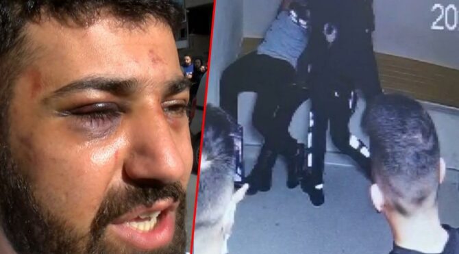 ‘Polis bana işkence yaptı’ dedi! Akılalmaz görüntüler ortaya çıktı