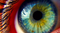 Eye Color Change Turkey İçin Hasta Bilgilendirme Rehberi